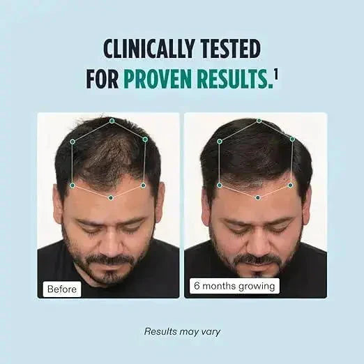 Nutrafol Men Balance Hair Growth Supplement Pack of 2 - Clearance Sale